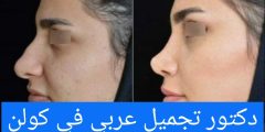 دكتور تجميل عربي في كولن