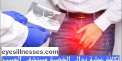 تكلفة عملية دوالي الخصية مستشفى الحبيب