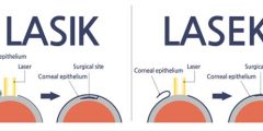 الفرق بين الليزك واللازك